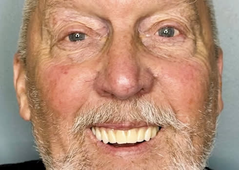 Case jim after query